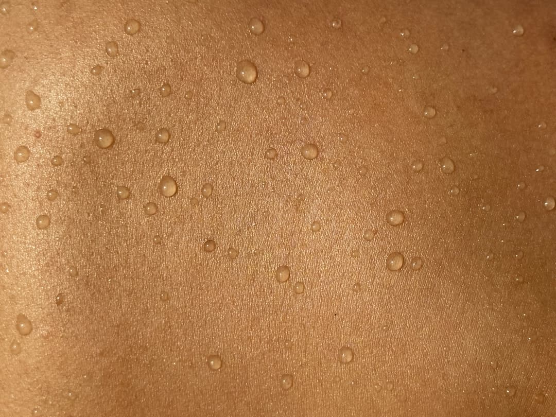 サウナのあまみとは何か?皮膚に現れる反応と健康効果を解説